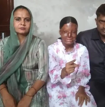 “Chandigarh Teen Overcomes Acid Attack to Score 95.6% in Class 12 Boards”
