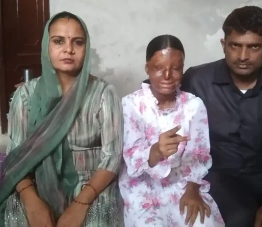 “Chandigarh Teen Overcomes Acid Attack to Score 95.6% in Class 12 Boards”